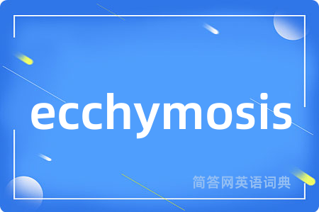 ecchymosis