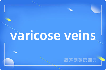 varicose veins